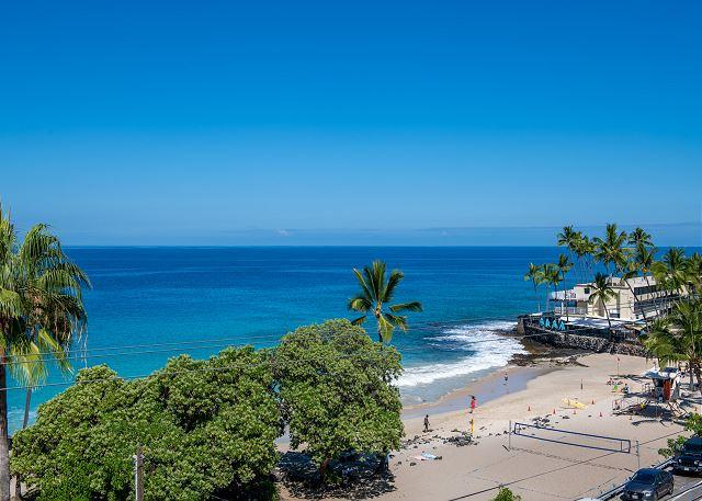 White Sands Village - 2BR Condo Ocean View King #313 photo 4